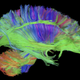 Illustration for article titled This Isnt a Fright Wig. Its How GEs MRI Scanner Sees Your Brain